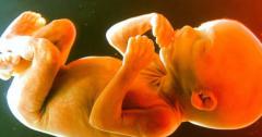 В Златоусте дети нашли человеческий эмбрион